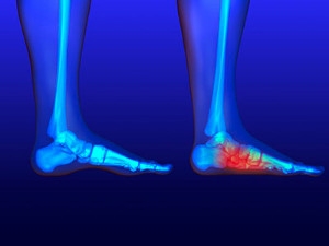 Facts About Flat Feet