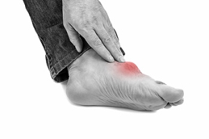 What Can Cause Gout?