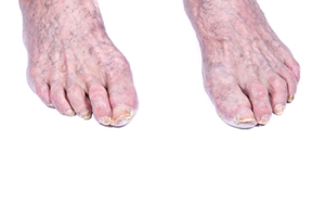 Understanding Foot Changes That Come With Age