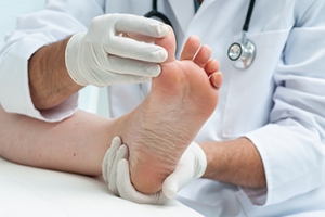 What Is Moccasin-Type Athlete’s Foot?